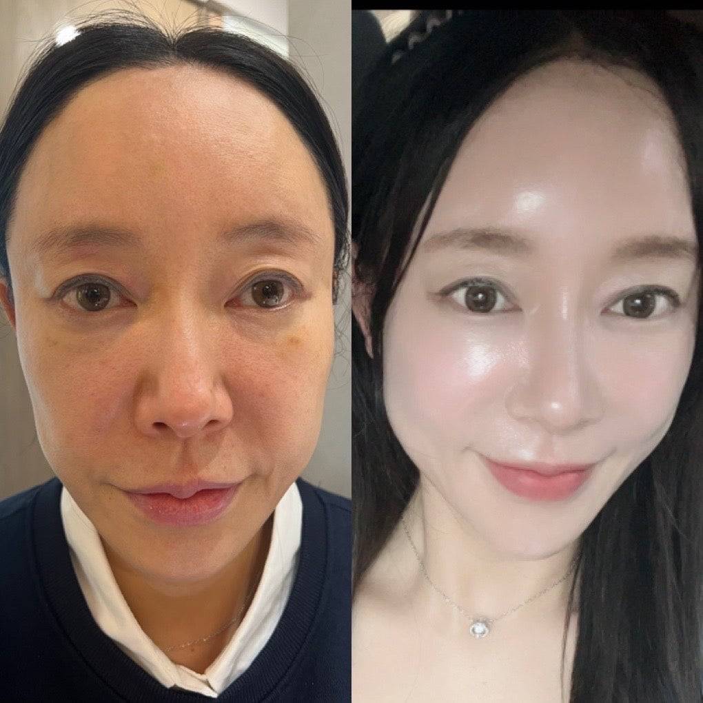インセルダム日本公式代理店（INCELLDERM） ICD