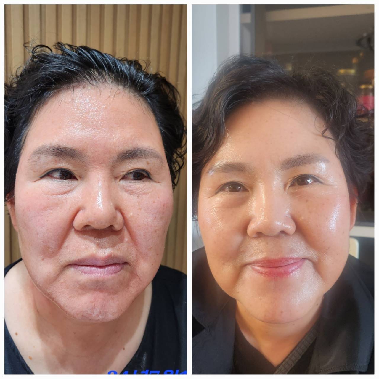 インセルダム日本公式代理店（INCELLDERM） ICD