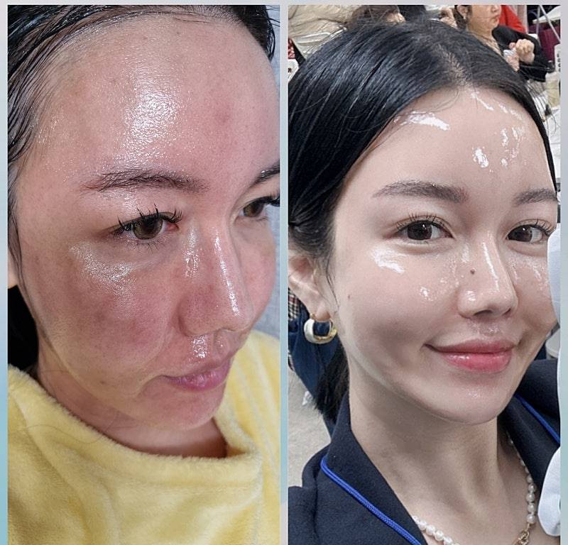 インセルダム日本公式代理店（INCELLDERM） ICD