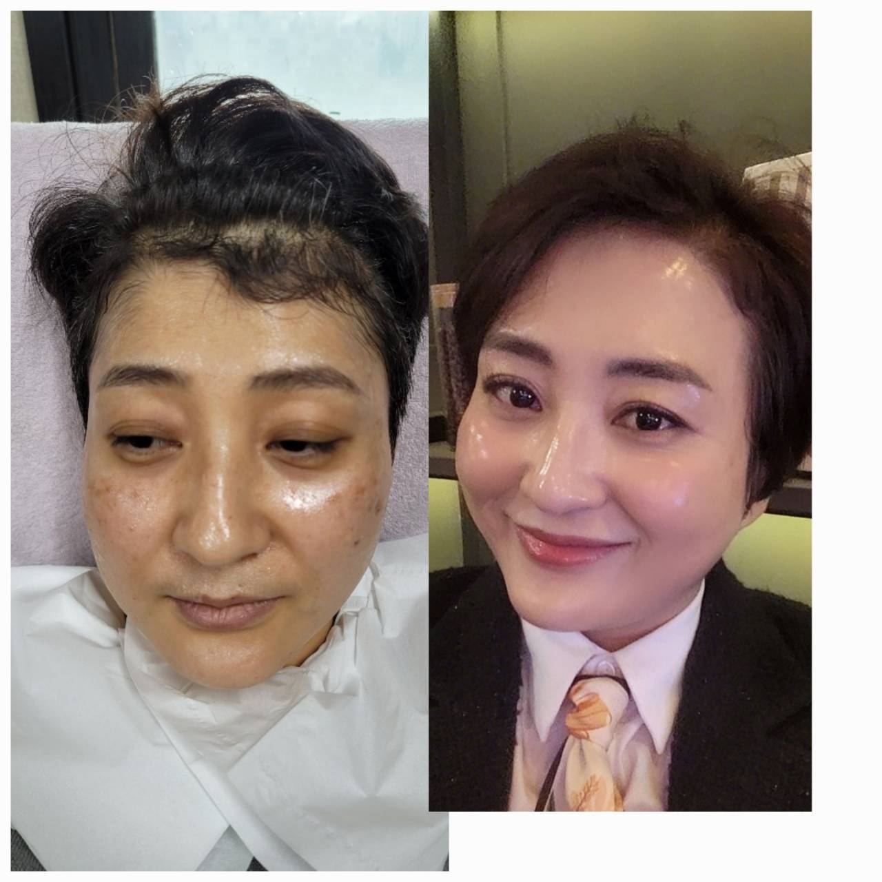 インセルダム日本公式代理店（INCELLDERM） ICD