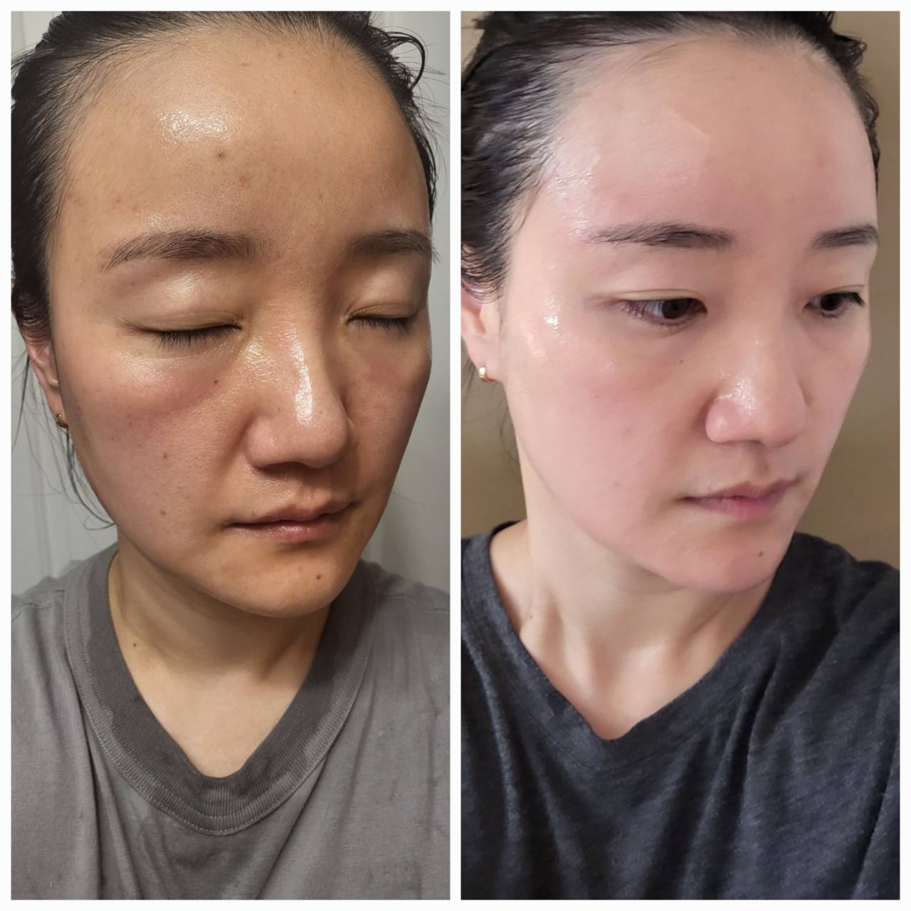 インセルダム日本公式代理店（INCELLDERM） ICD