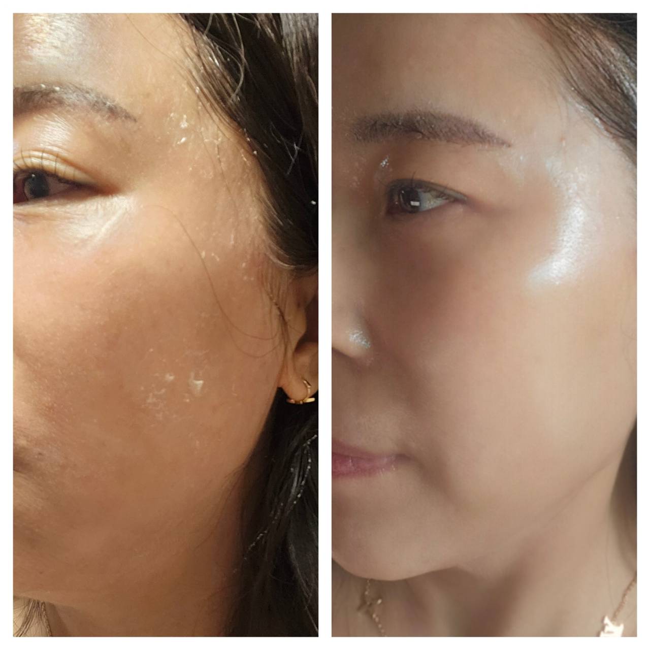 インセルダム日本公式代理店（INCELLDERM） ICD