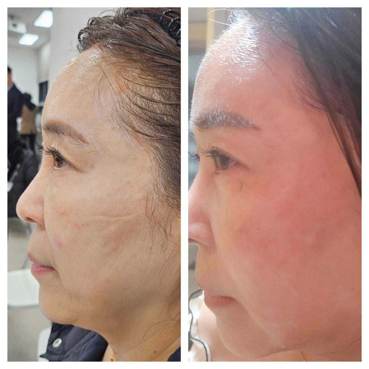 インセルダム日本公式代理店（INCELLDERM） ICD