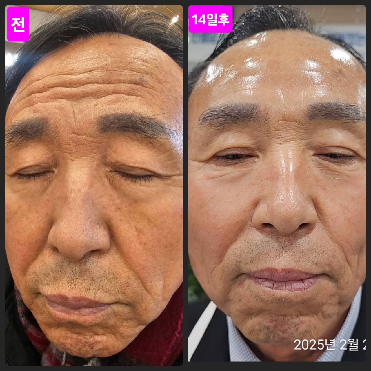 インセルダム日本公式代理店（INCELLDERM） ICD