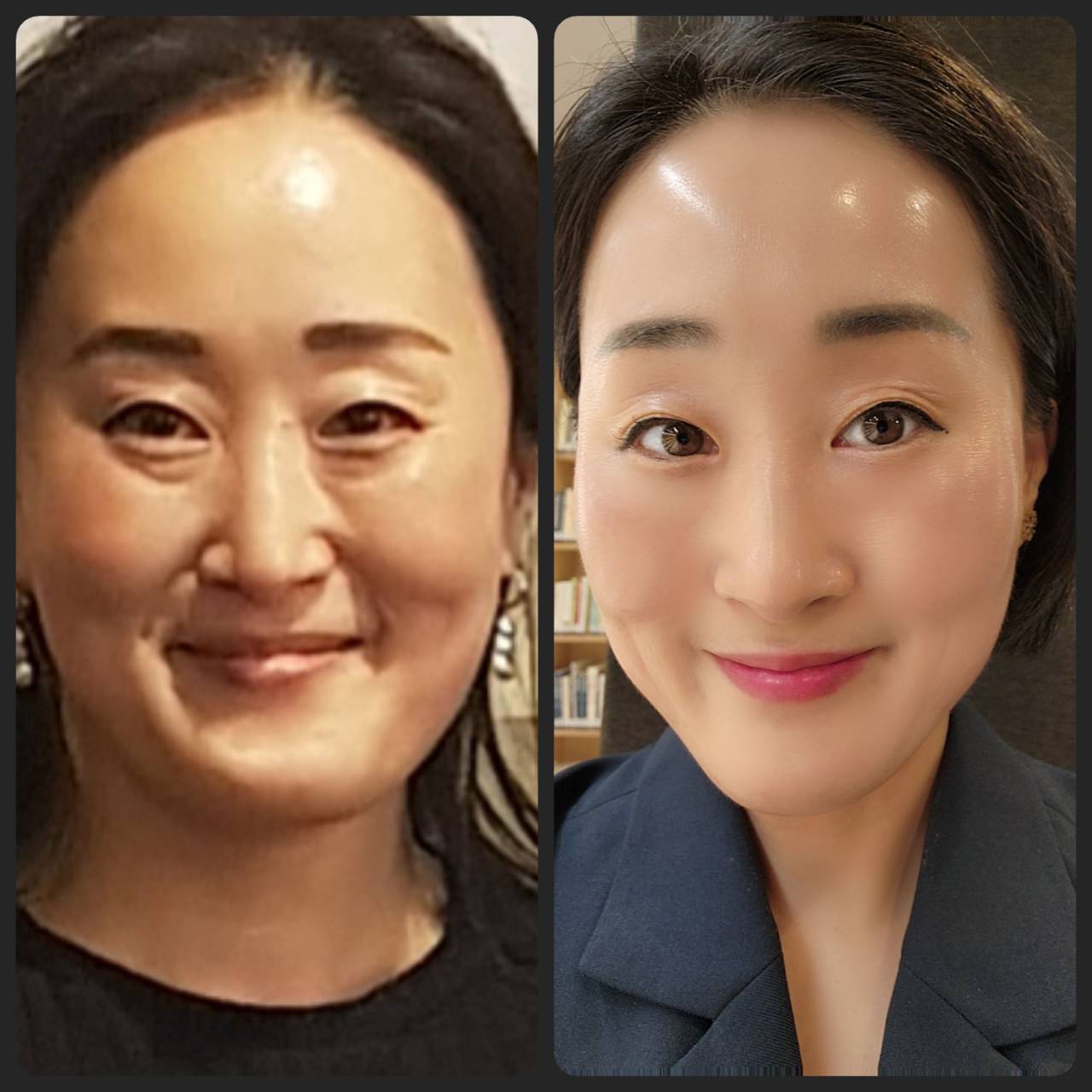 インセルダム日本公式代理店（INCELLDERM） ICD