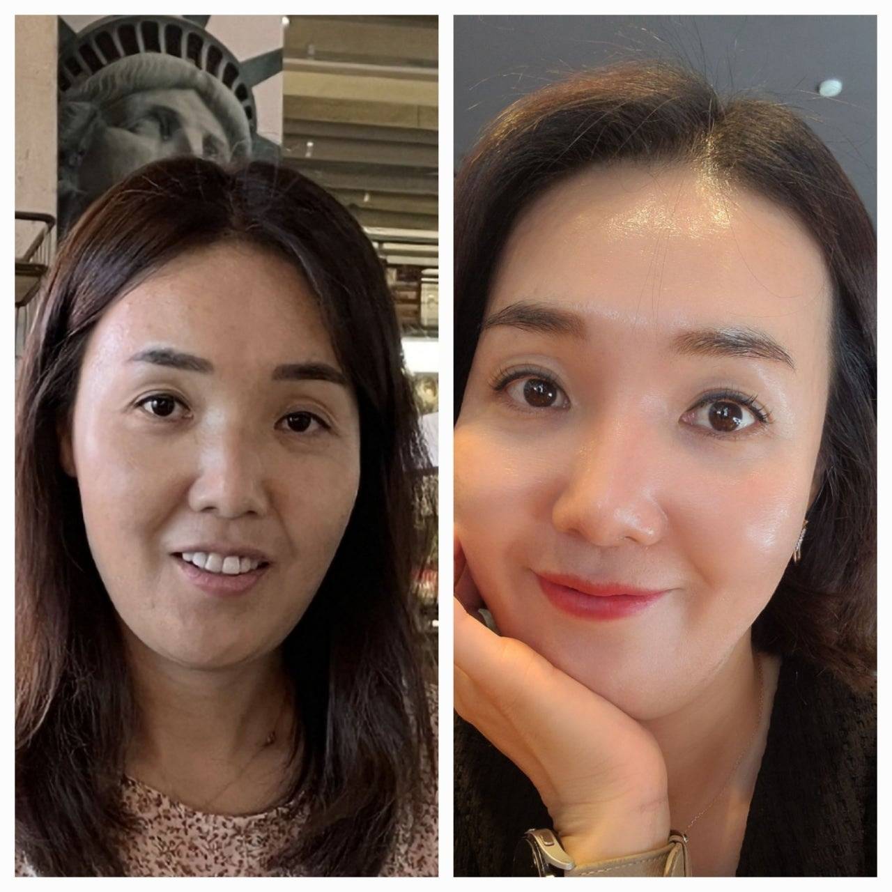 インセルダム日本公式代理店（INCELLDERM） ICD