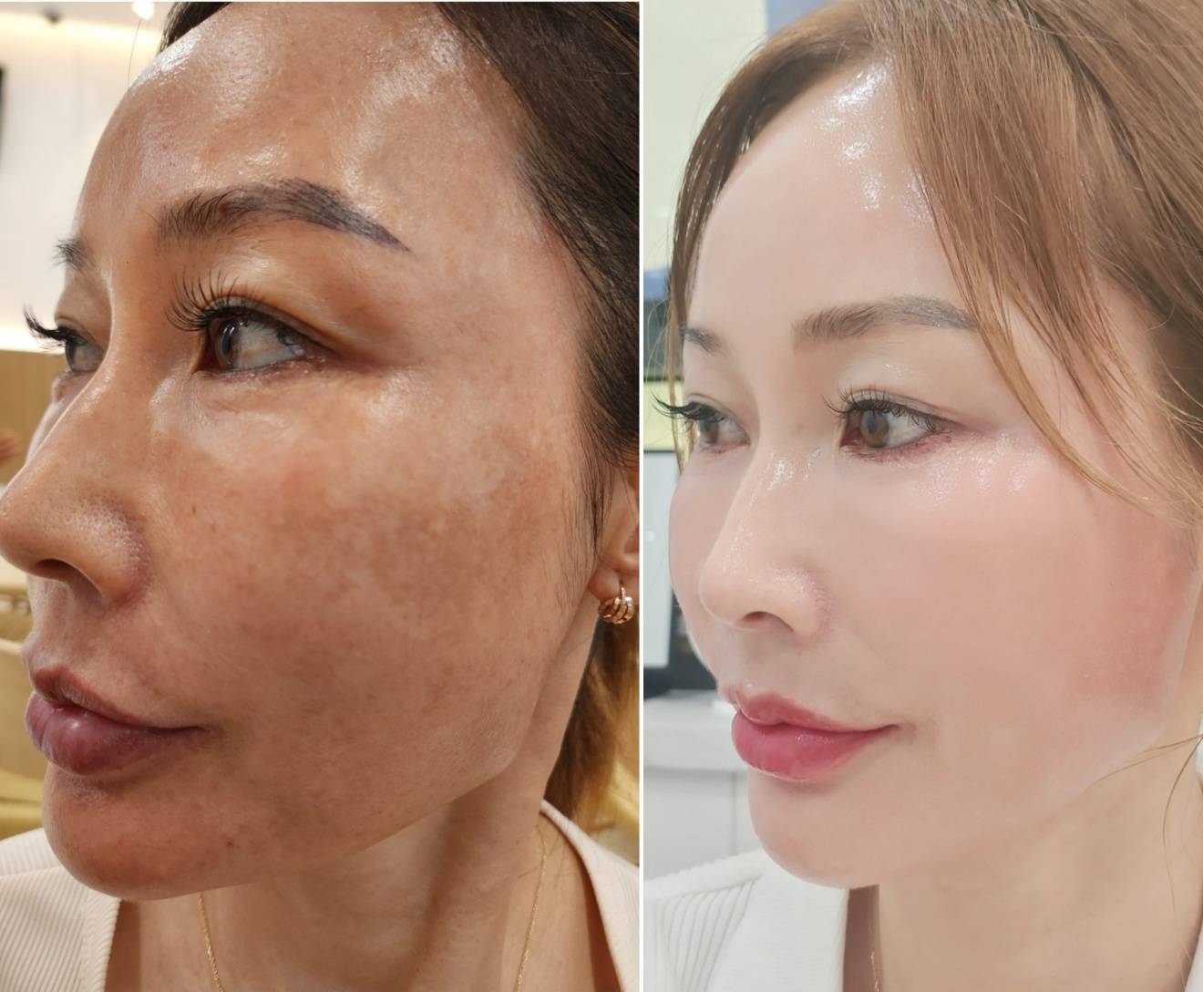インセルダム日本公式代理店（INCELLDERM） ICD