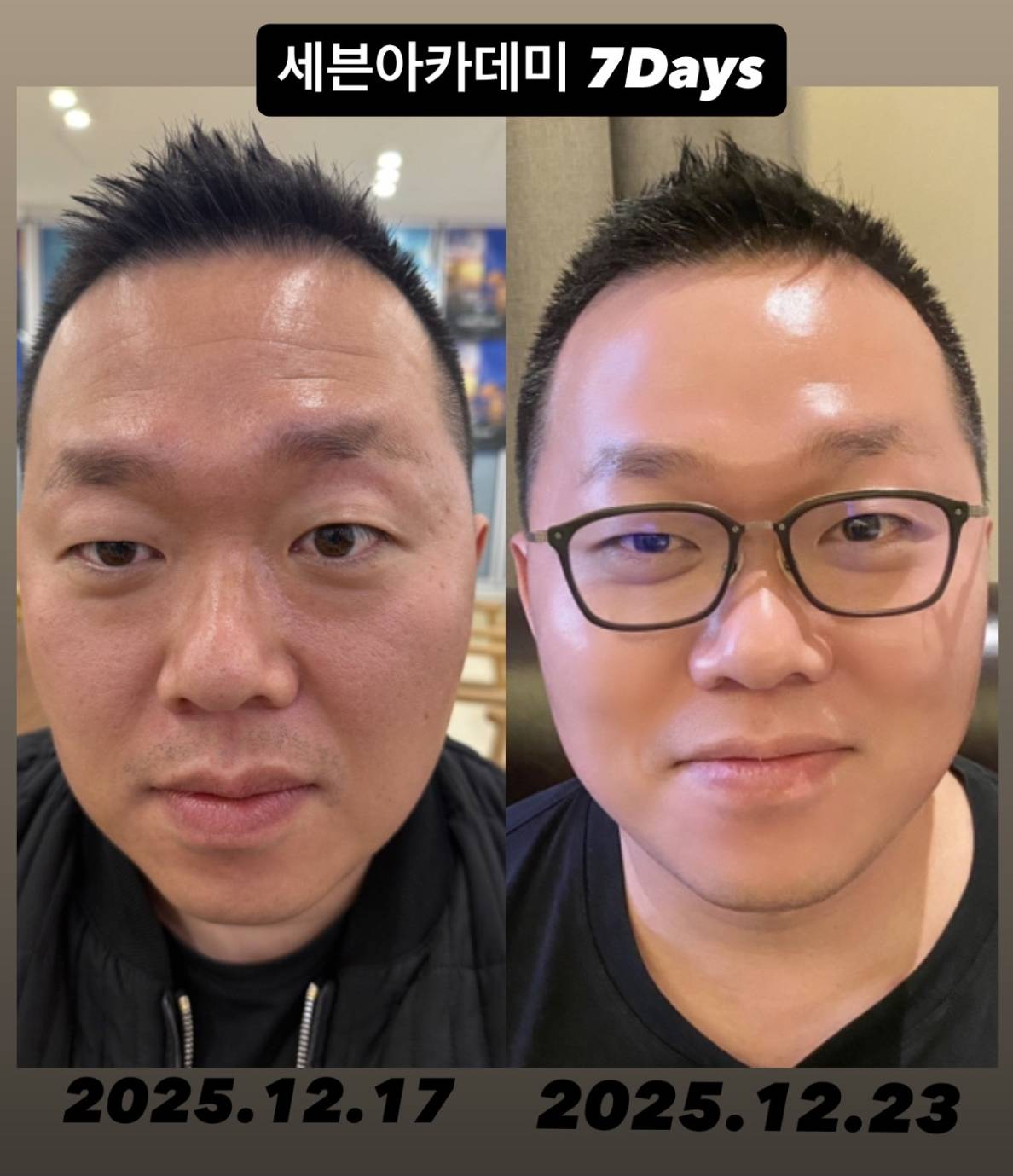 インセルダム日本公式代理店（INCELLDERM） ICD