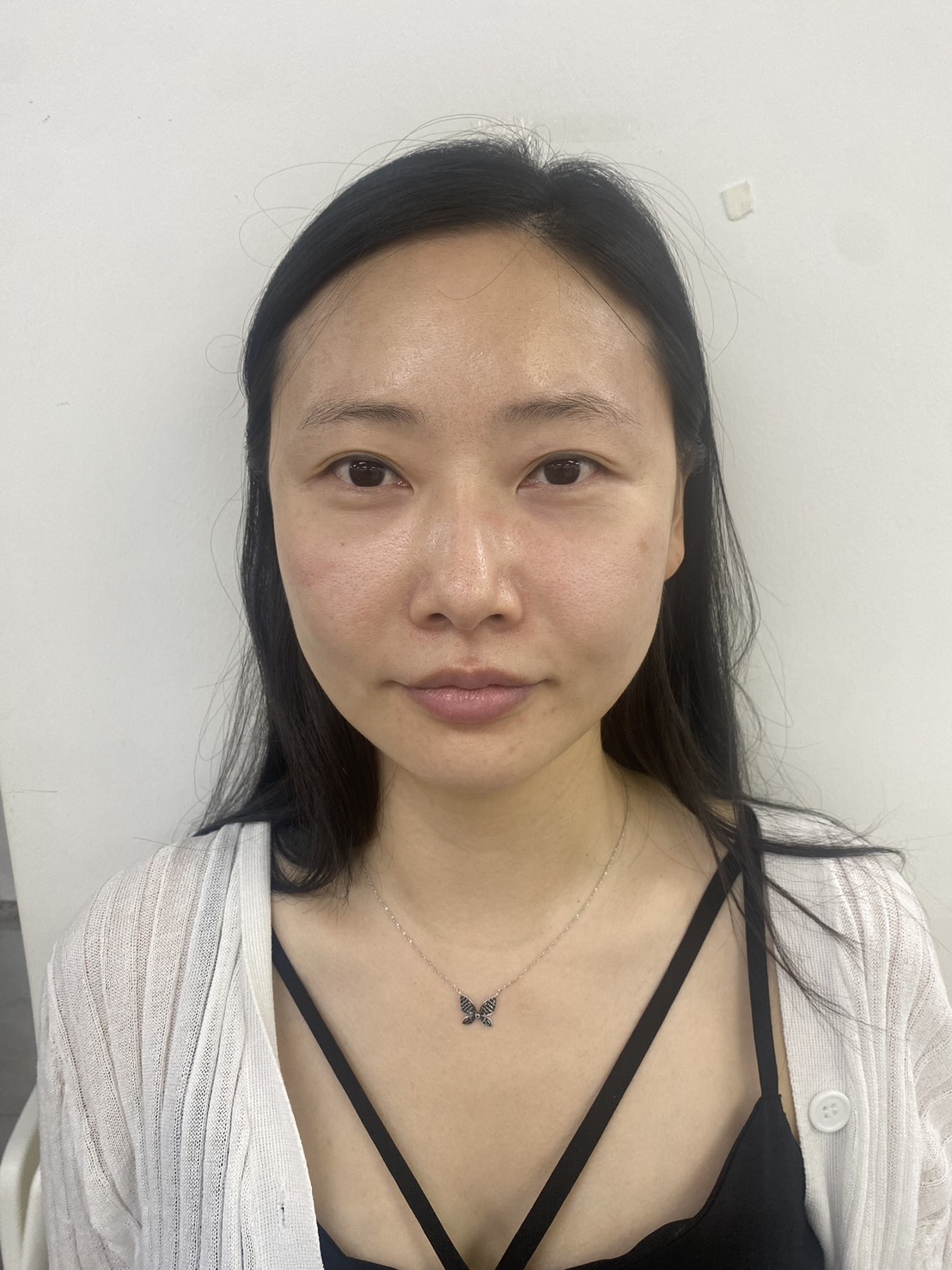 HOW TO 7DAYS Change - インセルダム(INCELLDERM)最初の7日間